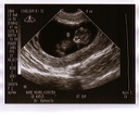 baby_sonogram_1b