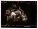 sonogram_8_16_06-1