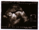 sonogram_8_16_06-2