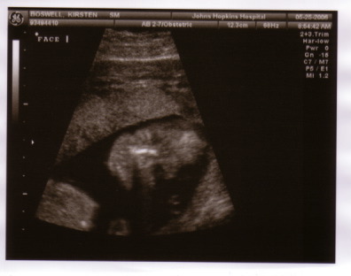 baby_sono_face_5_25_06.jpg
