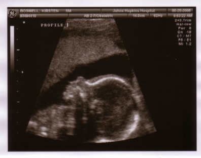 baby_sono_profile_5_25_06.jpg