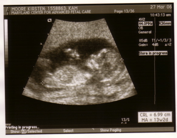 baby_sonogram_2_27_06.jpg