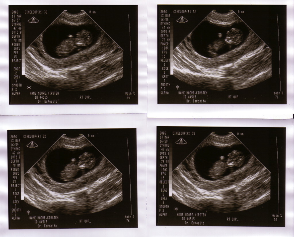 baby_sonogram_4x.jpg