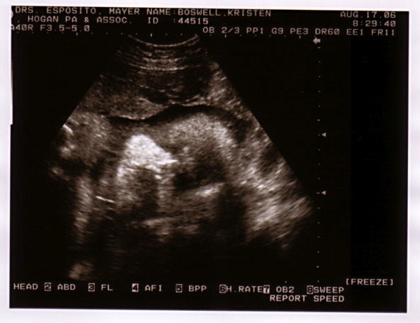 sonogram_8_16_06-1.jpg