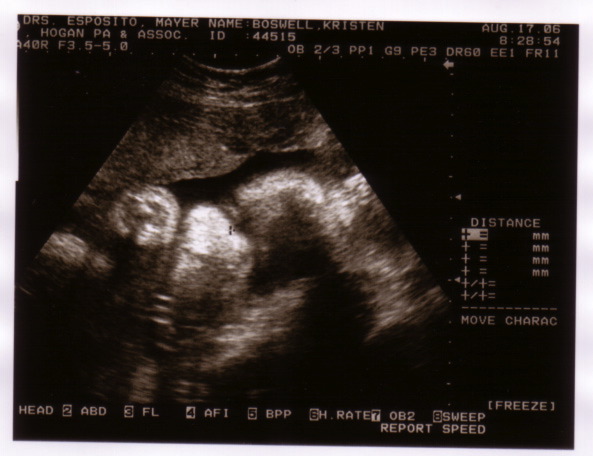sonogram_8_16_06-2.jpg