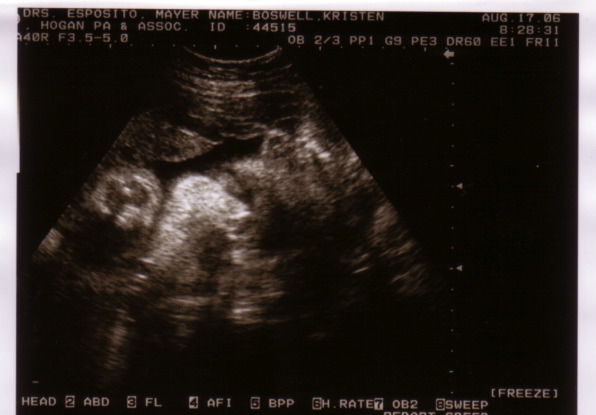 sonogram_8_16_06-3.jpg